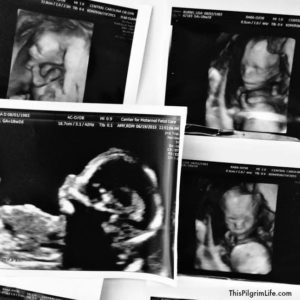 God Moves In A Mysterious Way-- The Life of Our Son, James Henry